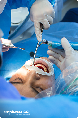 cirurgia-implante-protocolo