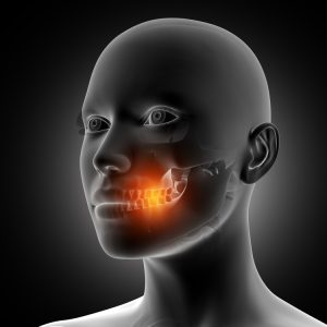 Cirurgia Ortognática